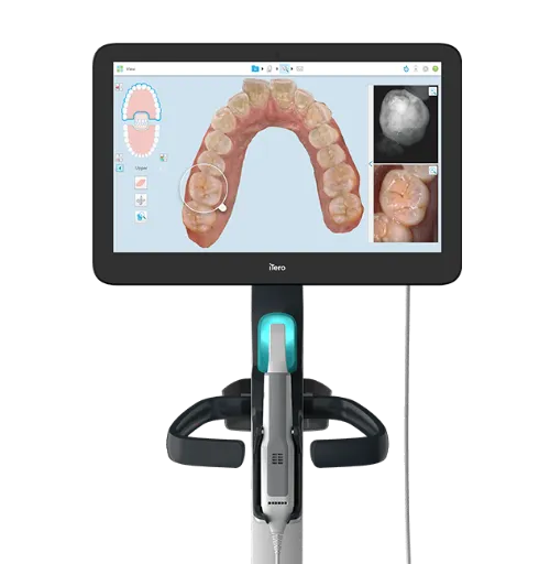 iTero Element 5D intraoral scanner used by Dr. Carla Christoph for digital dental planning in Ipanema